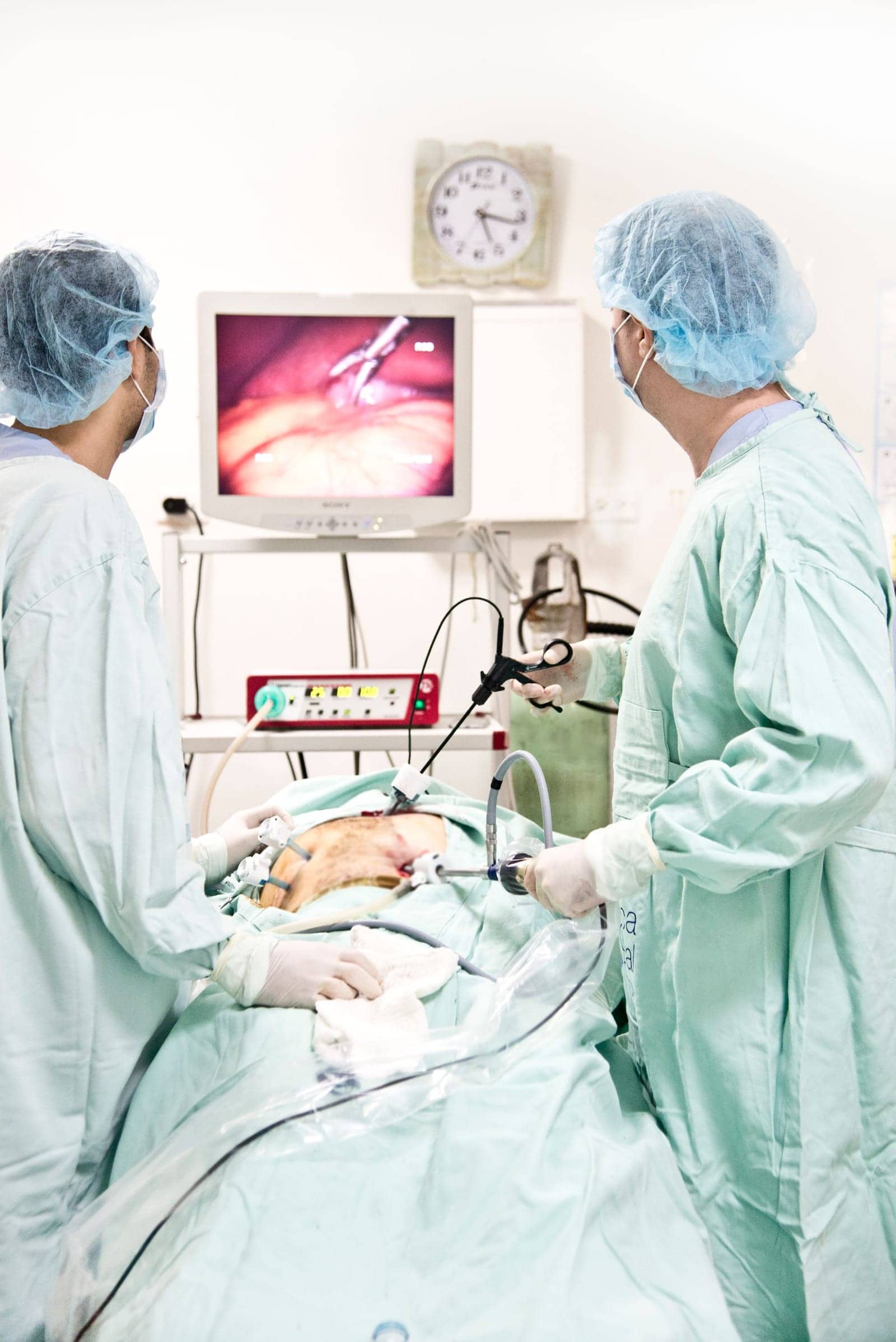 Surgeons performing a laparoscopy, with the camera view on a monitor above the table
