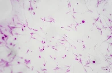 Sperm cells under the microscope